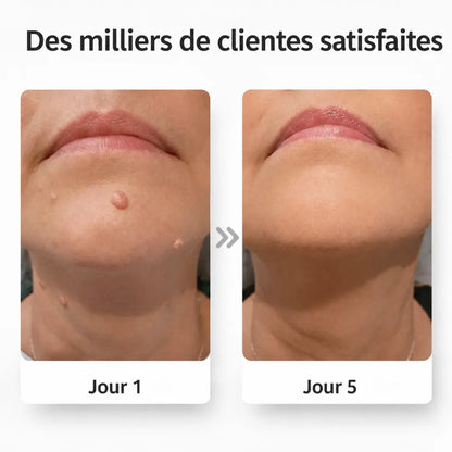 PeauClaire – Patchs pour la peau