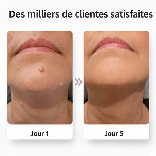PeauClaire – Patchs pour la peau
