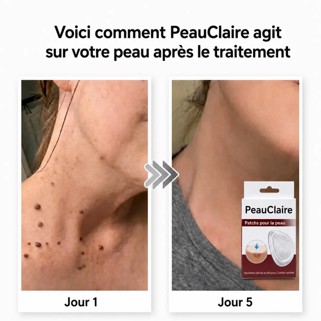 PeauClaire – Patchs pour la peau
