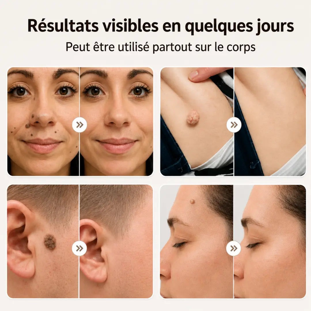 PeauClaire – Patchs pour la peau